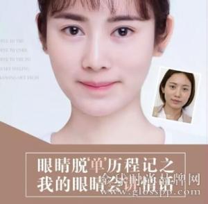 Yestar北京艺星整形:艺星整形让美更浑然天成