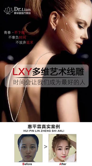 连喜艳线雕提升