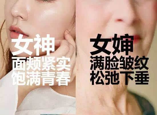 连喜艳线雕提升