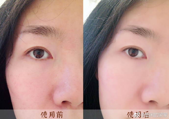 高清大图浏览 薇姿新出肌底液,宝妈也能用吗