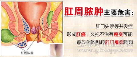 肛周脓肿g.jpg