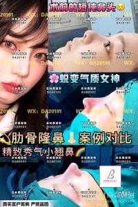 上海雅尚医疗美容和上海澳雅整形鼻整形哪个更好，查看最新案例