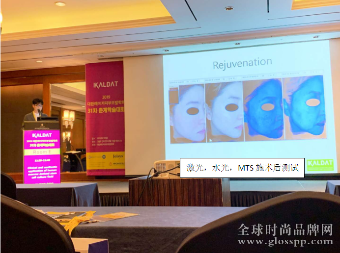 第31届韩国KALDAT激光皮肤毛发学术会发表摩菲斯人体骨髓干细胞培养液临床论文 滚动 第5张