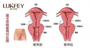 露卡菲娅效果怎么样？权威解答！