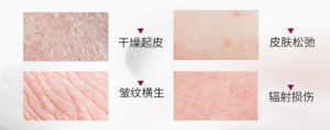 SingulaDerm圣歌兰，探索科学抗衰老的秘密